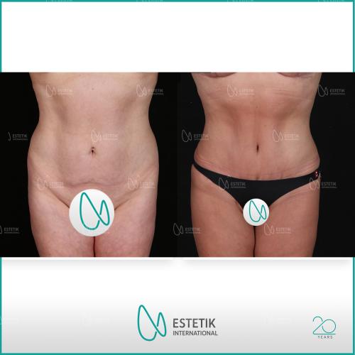 Before after photos of our patients 3